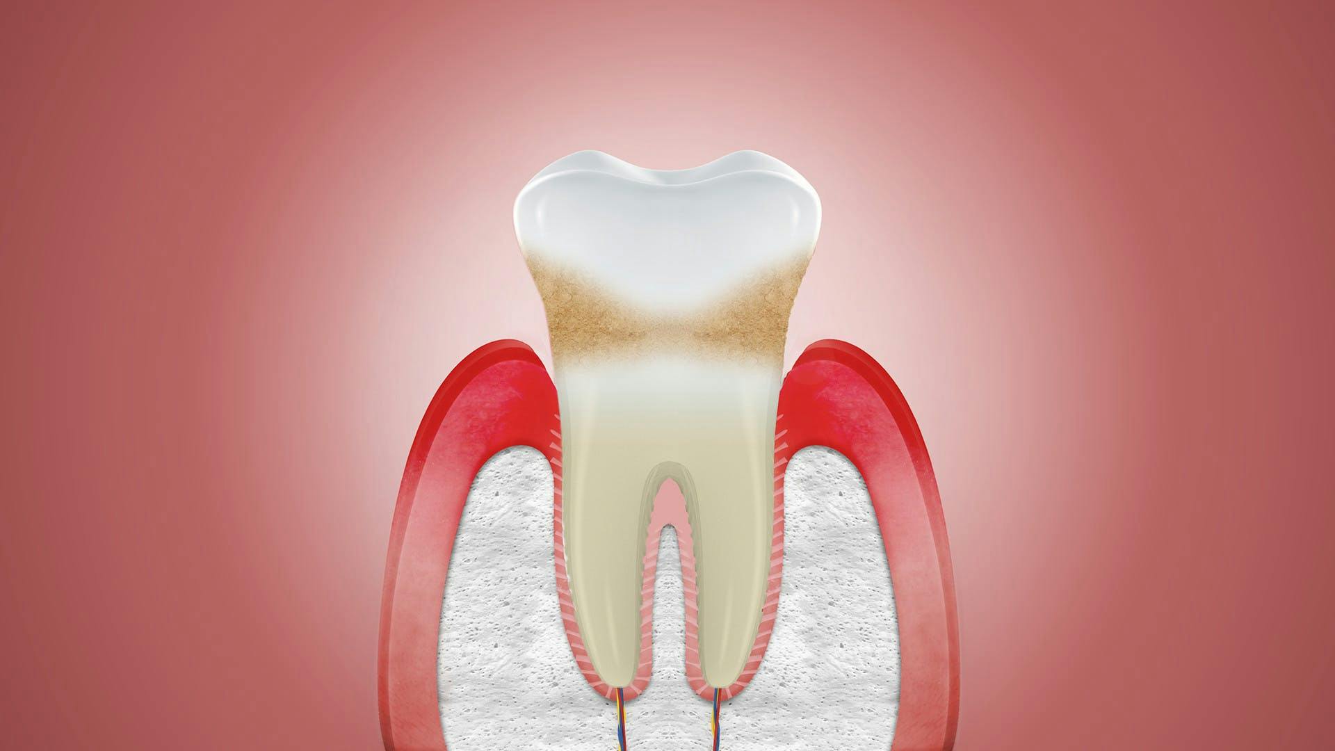 Can receding gums grow back? | Corsodyl